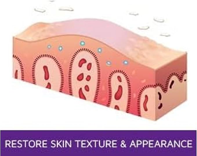 Exfoliating & Moisturizing Ointment – 4oz | Psoriasis Care to Restore Dry, Rough, Cracked or Scaling Skin - Salicylic Acid, Shea Butter, Vitamin E, Steroid-Free | Great for Knees and Elbows