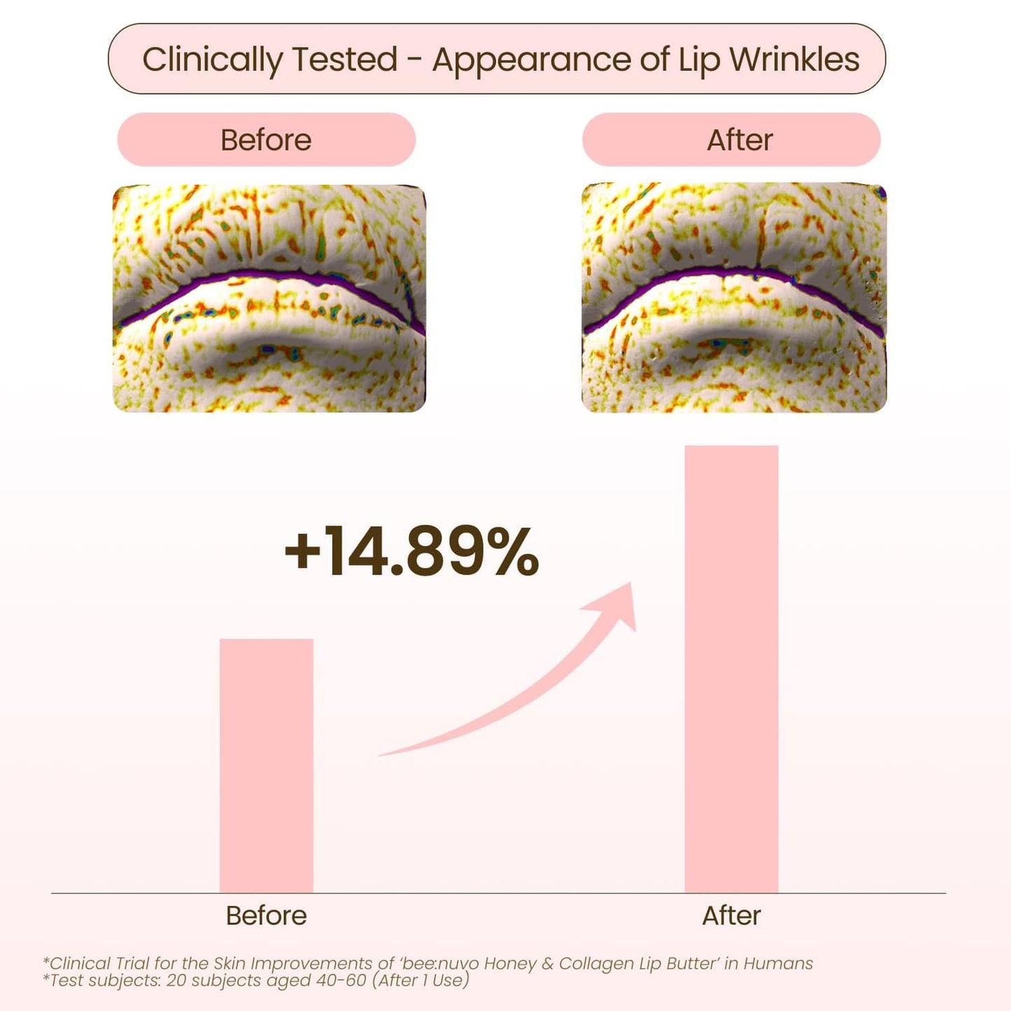 beenuvo Honey & Collagen Lip Butter, Hydrating Lip Treatment, Overnight Lip Mask, Moisturizing Lip Balm with Jojoba Oil & Squalane, Lip Care, Korean Skin Care (0.45 oz)