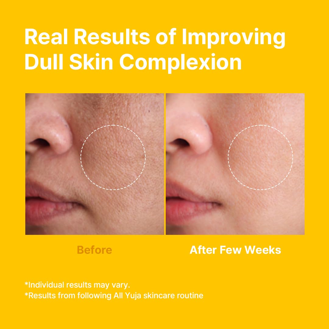 FARMSTAY Citrus Yuja Vitalizing Cream – Vitamin C Facial Moisturizer with Niacinamide for Dry & Sensitive Skin, Skin Barrier Repairing & Wrinkle Care, Korean Skincare, for Women & Men 3.52 oz.