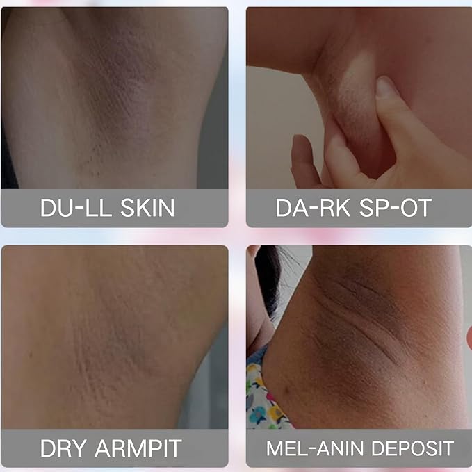 Sakura Skin Wh-ite-ning Cream Women Moisturizing - Da-rk Sp-ot Corrector Underarm Cream - Sk in Ble-aching Cream for Body Armpit Wh-ite-ning - Women Skin Lig-hte-n ing cream with Hyaluronic & Collagen