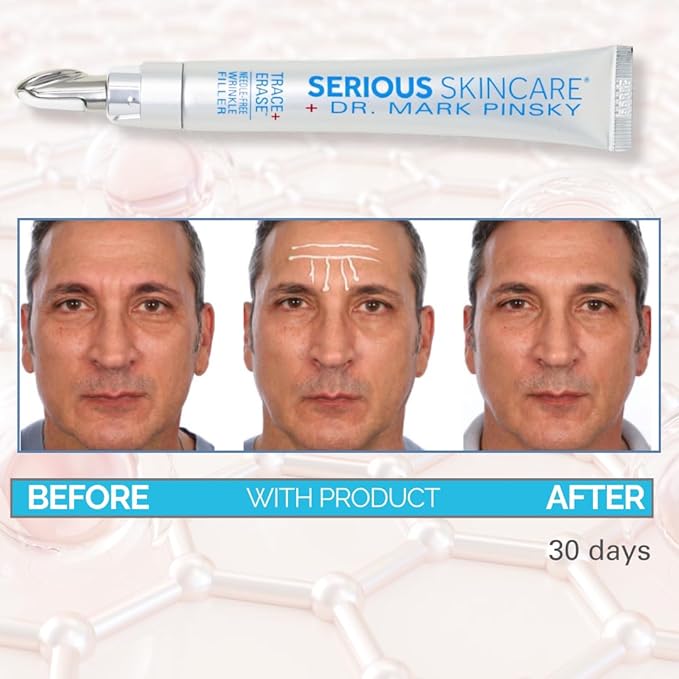 Serious Skincare - Deep Wrinkle Filler for Face and Neck - Dr. Mark Pinsky Trace + Erase Wrinkle Filler and Enzyme+ Prep Treatment Pads - For Plumper, Smoother Skin - Hyaluronic Acid and Peptides
