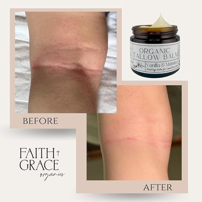 Organic Tallow Balm, Vanilla and Manuka Honey, All-purpose Moisturizer, Safe for sensitive skin, Healing balm, 2 oz glass jar