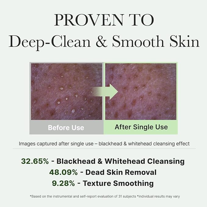Korean Rice Mochi Face Cleanser - Face Mask, Foaming Cleanser, Gentle Scrub All in One - Deep Cleansing, Moisturizing, Pore Minimizing, Removing Blackhead- with Rice Water & Green Tea, Mugwort