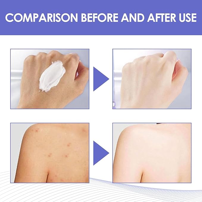 Skin VVhitening Cream for Intimate Areas – Vitamin C Body Care Cream for Dark Underarm, Armpit, Inner Thigh, Private Area, Elbow, Knees, Face, Bikini Line and Neck, Quick Results, 1.0 FL.Oz (1 PCS)