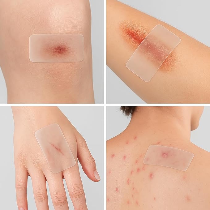 Clear Scar Sheets – 10 Pieces – Skin Patches for Face and Body – Use Before Scars Fully Form – Prevent and Reduce Scars from Acne, Scalds, Burns, Cuts, Abrasions – Thin, Flexible, Waterproof, Gentle