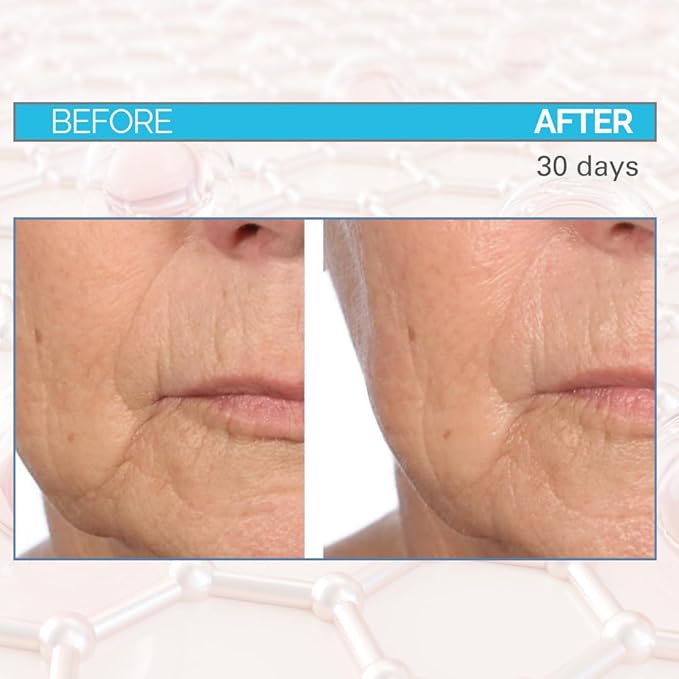 Serious Skincare - Deep Wrinkle Filler for Face and Neck - Dr. Mark Pinsky Trace + Erase Wrinkle Filler and Enzyme+ Prep Treatment Pads - For Plumper, Smoother Skin - Hyaluronic Acid and Peptides