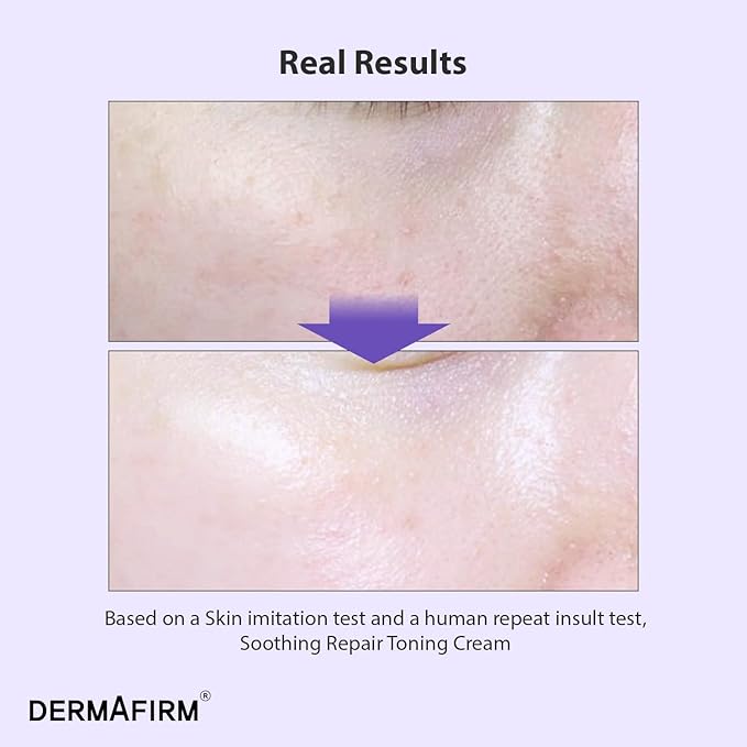 Dermafirm Soothing Repair Toning Cream - Korean Skin Care Moisturizer Face Cream w/Niacinamide, Bakuchiol, Glutathione & 8x Hyaluronic Acid - Vegan Glowing Skin Firming Cream (1.69 fl oz)