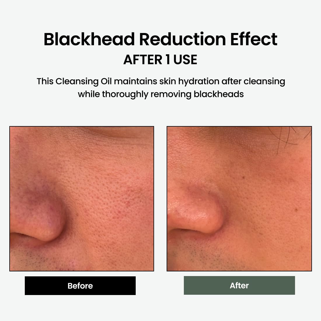 delphyr Liposome Daily Cleansing Oil, Gentle Makeup & Blackhead Remover for Sensitive Skin with Centella Asiatica TECA, Korean Skincare for Trouble Care (6.76 fl. oz., 200ml)