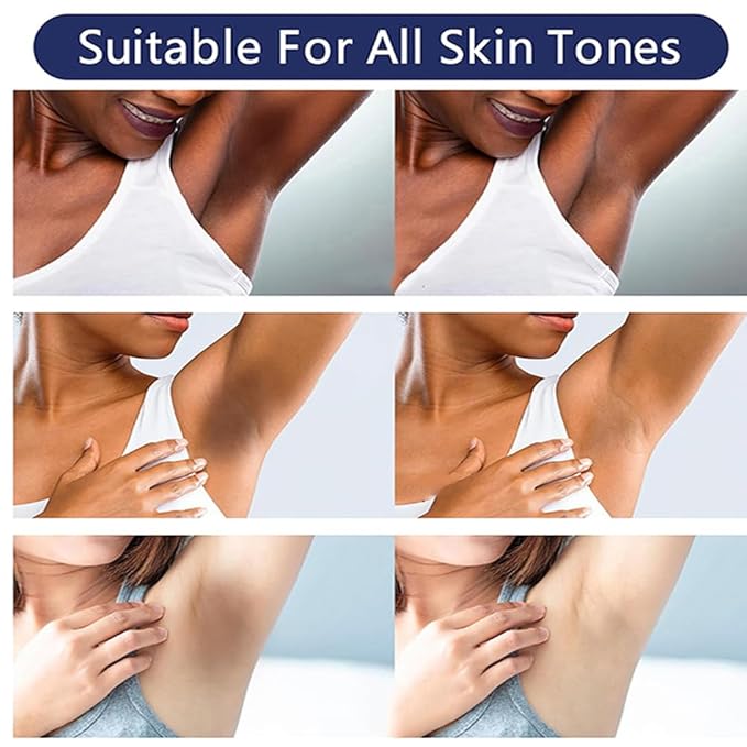 Crema para Aclarar las Axilas y Partes Intimas, Para Piel Entrepierna, Manchas Codos, Piernas Zonas, Íntimas Cara Axilas, Rodillas Cuello 50G (4 bottles loción de cuidado de axilas y partes intimas)