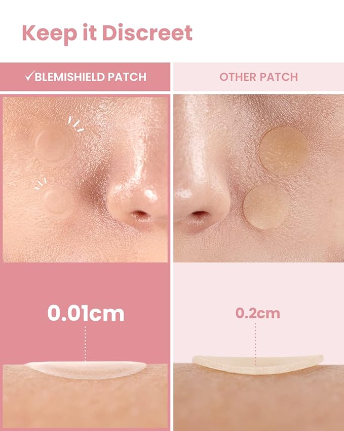 GLAM UP Hydrocolloid Blemish Pimple Zit Patches(180PCS/2Size) - Invisible Ultra Thin Spot Cover Stickers for Face and Skin, Strong Water-proof and Adhesive Overnight, Vegan-friendly