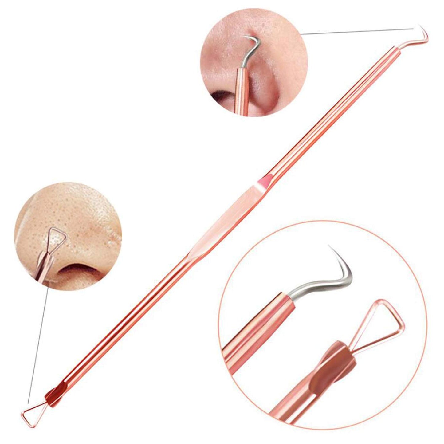 ZTRHYOO Blackhead Remover Pimple Comedone Extractor Tool Best Acne Removal Kit - Treatment for Blemish, Whitehead Popping, Zit Removing for Risk Free Nose Face Skin with Case(Rose, 4 Piece Set)