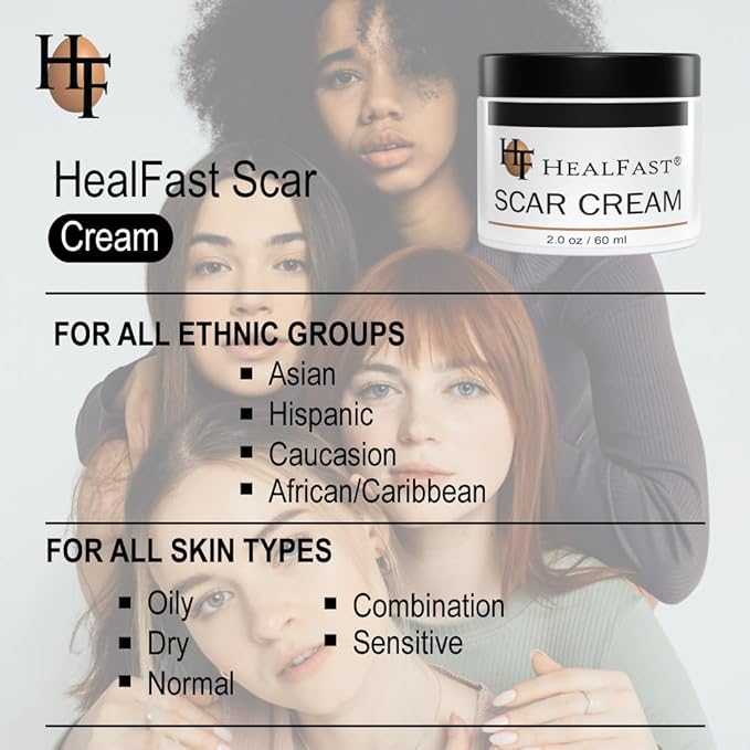 The Original Scar Cream for Stretch Marks – Soothes, Nourishes and Refreshes Skin – Using Ovasome Technology with Allantoin & Alpha LIpoic Acid – 2 Oz/ 60 ml