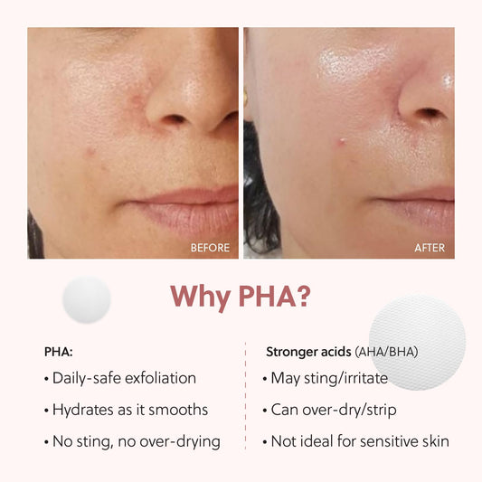 QUIA Dual-Action Toner Pads – Exfoliate and Hydrate Pores in One Step – Soothing PHA Formula for Sensitive Skin – Reduces Blackheads and Blemishes- 70 Textured Pads – Korean Skincare