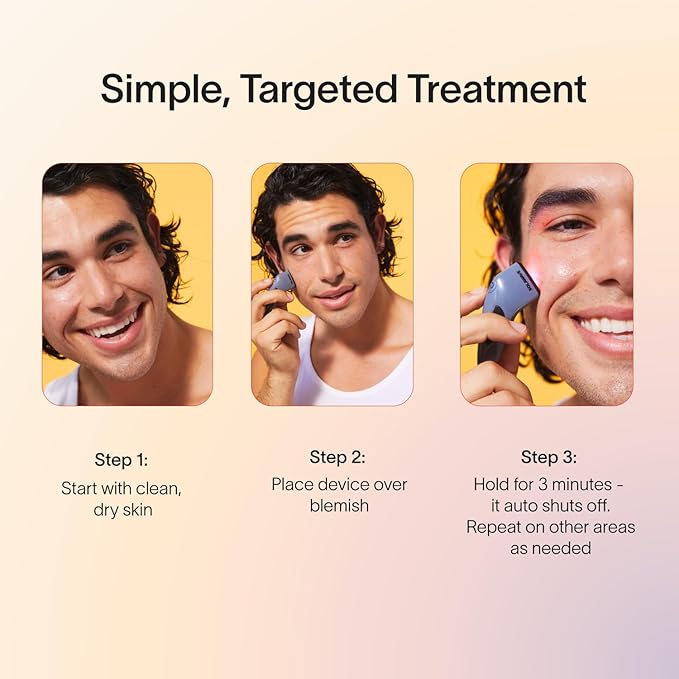 Solawave Bye Acne Spot Treatment | Blue & Red Light Therapy Device for Pimples & Zits | Face Wand Reduces Inflammation, Redness, & Appearance of Blemishes | 3-Min Sessions at Home for Clearer Skin