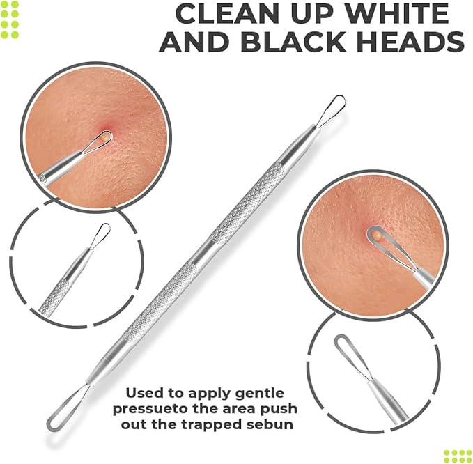 [2 Pcs] Pimple Extractor Tool 2025 Latest - Comedone Extractor, Pimple Popper, Blackhead Remover for Face, Zit Popper, Pimple Needle for Acne Removal