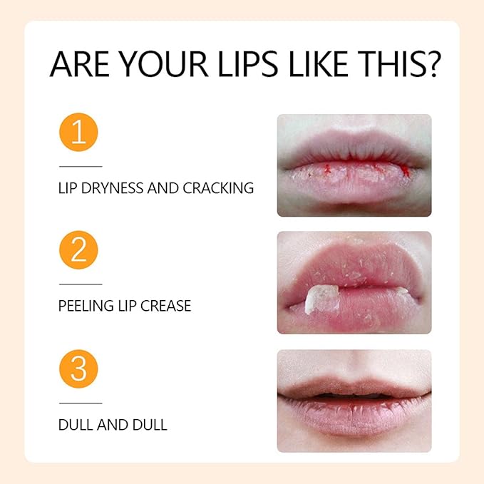 Honey Pot Lip Balm, 4Pcs Honey Hydrating