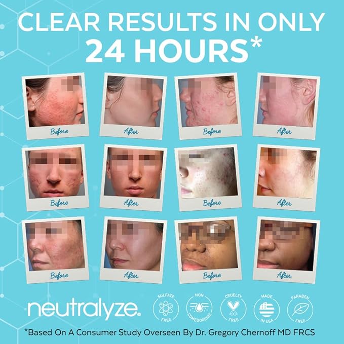 Moderate To Severe Acne Treatment Kit 2.0 (Clearing Serum & Synergyzer)