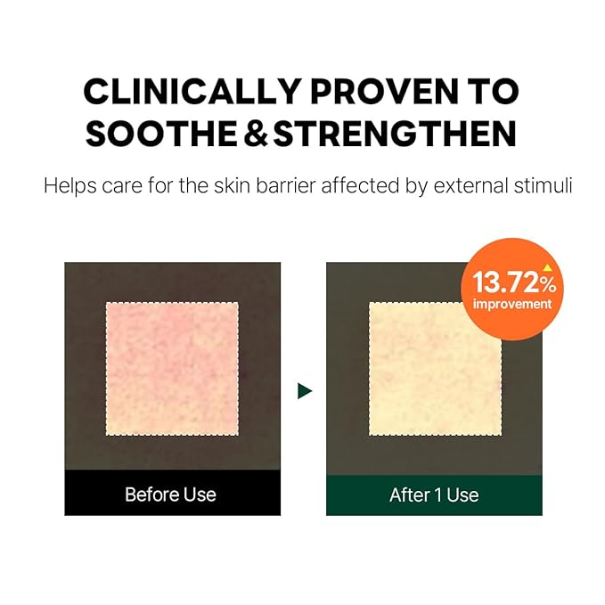 ROUND LAB Pine Cica Calming Cream Plus 60ml – Dual-Texture Soothing Cream for Blemish Care, Acne-Prone Skin Safe, Sebum & Oil Control, Intensive Calming, Strengthens Skin Barrier, Clear & Calm Finish