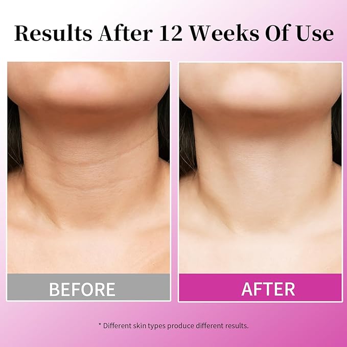4 in 1 Retinol Moisturizer Cream, Tightening & Lifting Neck Cream, Advanced Anti-Aging Face Moisturizer, Reduces Fine Lines & Wrinkles for Neck & Face & Chest (50 ml/1.7 oz)