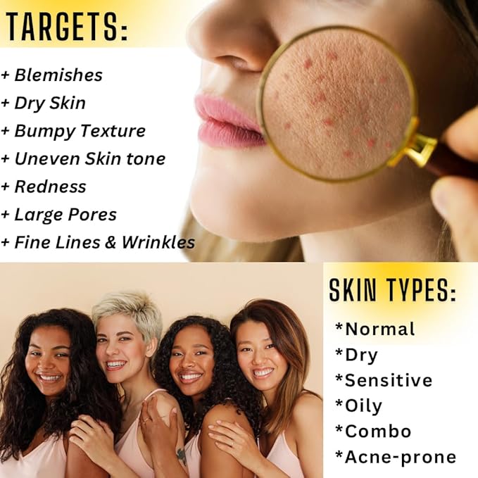 Snail Mucin Serum with Hyaluronic Acid & Collagen – Fragrance-Free Hydrating Serum for Sensitive, Acne-Prone, Dry & Oily Skin – Soothes Redness, Repairs Damage & Enhances Skin Elasticity
