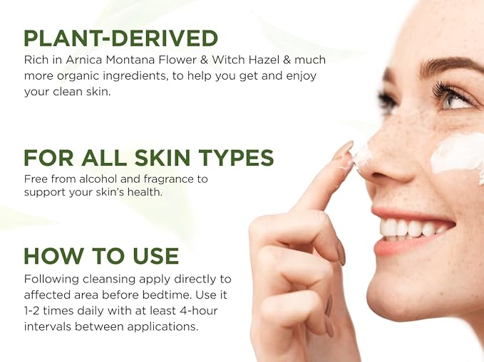 Cystic Acne Spot Treatment – Tea Tree Acne Cream – Fast-Acting Acne Spot Corrector for Face, Pimples & Blemishes – Non-Greasy, Gentle Formula – 1oz – by WELLUTION