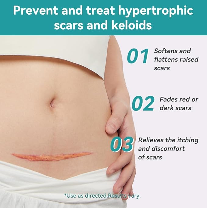 Dimora Medical Grade Silicone Scar Sheets - Ultra Soft Silicone Scar Tape (1.6”x120" Roll), Waterproof Scar Treatment for Surgical Scars, C Section, Tummy Tuck, Keloid Treatment