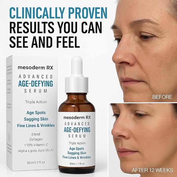 Advanced Age-Defying Serum, Triple Action for Age Spots, Sagging Skin, Fine Lines & Wrinkles, 1 fl oz