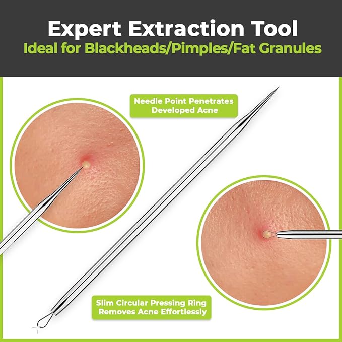 [6 Pcs] Blackhead Remover Tools for Acne - Surgical Stainless Steel Pimple Popper Tool Kit, Comedones & Blemish Extraction Kit