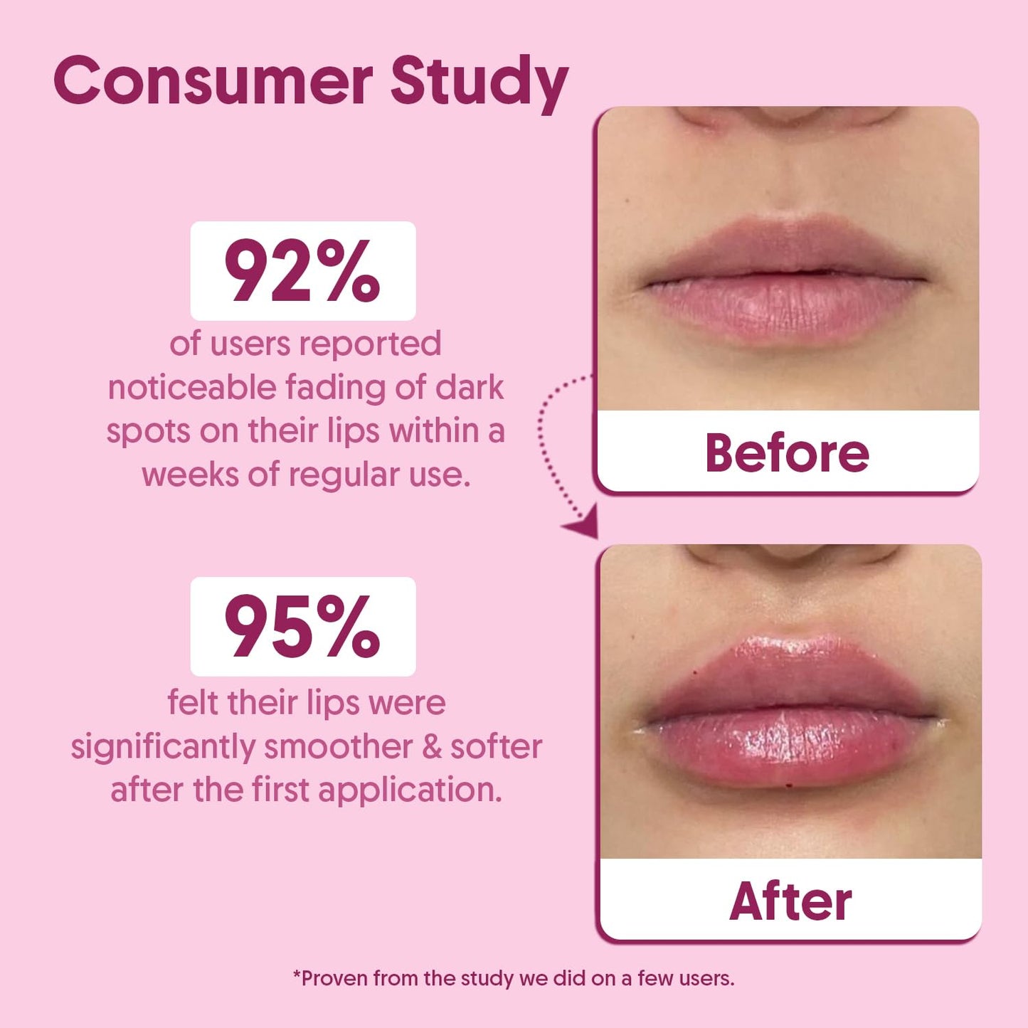 Aravi Organic Beetroot Lip Scrub with Shea Butter & Cocoa Butter – For Dark, Chapped & Pigmented Lips – Suitable for Men and Women - 0.5 FL Oz / 15gm