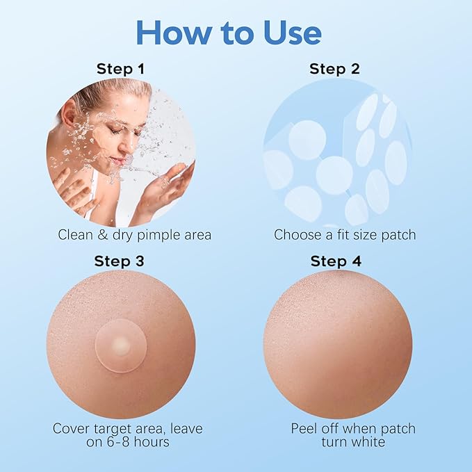 Large Pimple Patches for Face 331 Patches-7 Size,306 Round & 25 XL Acne Patches,Zit Patches Skincare Hydrocolloid Bandages Big Spot Covers with Tea Tree, Salicylic Acid & Cica Oil|Bigpack, Larger Size