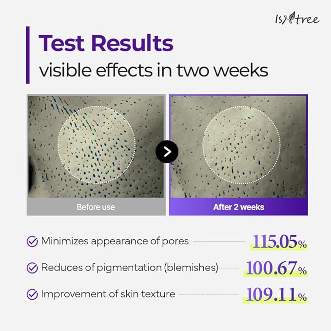 ISNTREE Onion Newpair Booster 2000s 1.69 fl.oz | Spicule Microneedling Facial Serum | Panthenol, Hyaluronic Acid, Collagen, Cica | Pore Care, Pigmentation, Skin Texture | Korean Skin Care