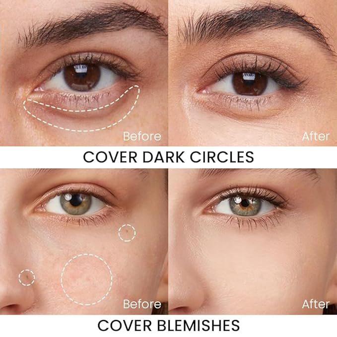 Kaely Dual-Ended Concealer Stick,Acne Dark Spot Corrector Makeup Brightener Waterproof,ight+Neutral 01 L