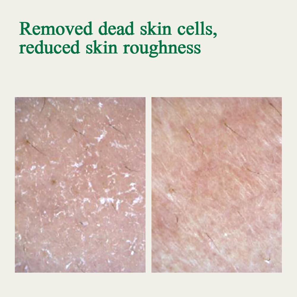 Pyunkang Yul PKY Ultimate Calming Solution Ampoule for Sensitive Skin with Patented Ingredients, Serum Intensely Calms & Soothes Redness with Cica & Tea Tree, Korean Skincare (1.01 Fl. Oz, 30ml)