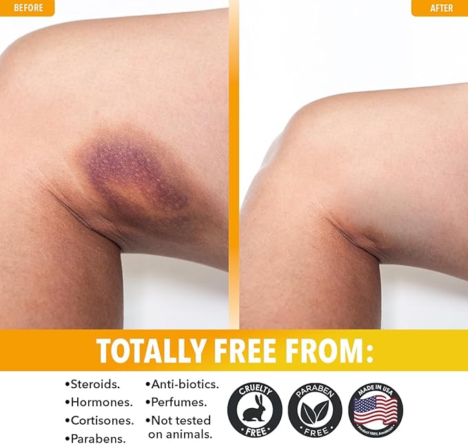 Dr. Robaina Arnica Bruise Cream 4 oz – Concentrated Arnica & Vitamin K Moisturizer for Skin That Looks More Even After Bumps & Cosmetic Touch-Ups – Fast-Absorbing, Non-Greasy, Made in USA