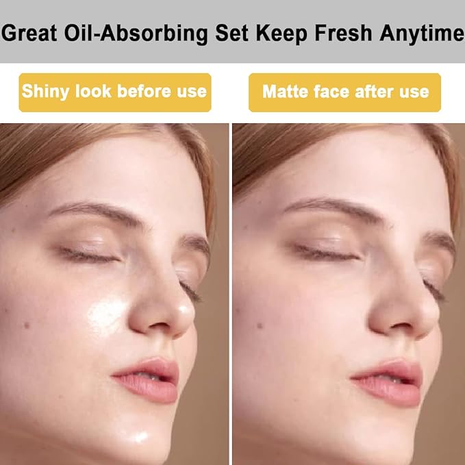 103 PCS Volcanic Roller Oily Skin Oil Control