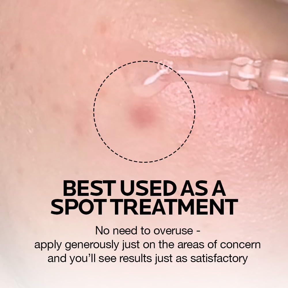 MIMUMIMU Dark Spot Remover Serum for Face | Korean Clinic Skincare - Thioctic Acid 0.01% & Niacinamide 5% | Spot Treatment for Melasma, Hyperpigmentation, Discoloration, Acne Scars | 30ml/1.01 fl.oz