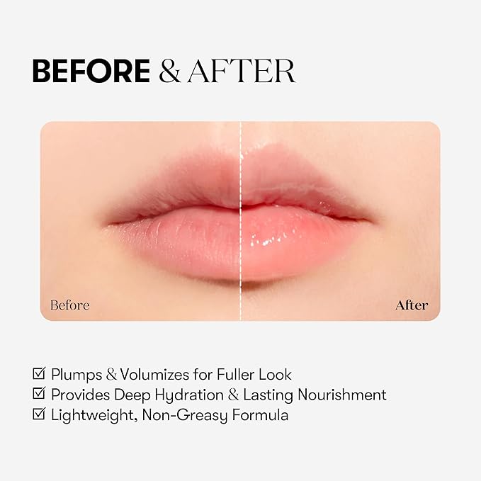 VT COSMETICS Reedle Shot Lip Plumper, Hydrating & Volumizing Clear Lip Gloss, Microneedling Effect & Hyaluronic Acid for Fuller, Smoother Lips, 0.15 oz (4.3 g) (Beginner)