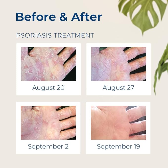 Gloves in a Bottle Skin Repair