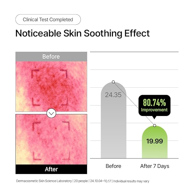 Parnell Panthenol 3.89% | 50ml / 1.69 fl.oz. | Heartleaf Calming Capsule Cream, Acne soothing cream, korea skin care, korea beauty