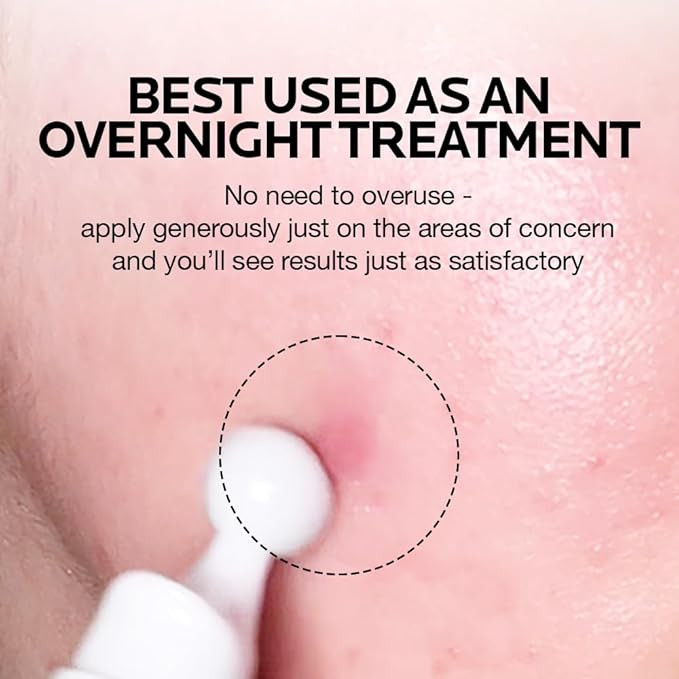 MIMUMIMU Dark Spot Remover for Face | Korean Clinic Skincare - Thioctic Acid 0.01% & Niacinamide 10% | Overnight Treatment for Melasma, Hyperpigmentation, Discoloration, Acne Scars | Pack of 2