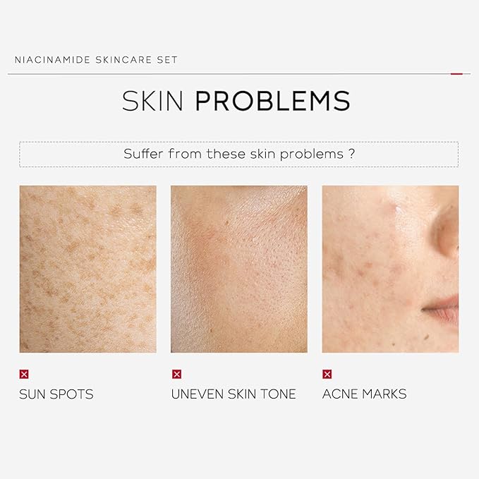 skin care set - skincare set