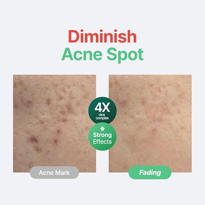 PURITO Centella Unscented Serum, 34,860 ppm Centella, Facial Serum for Sensitive Skin & Acne-Prone Skin, Soothing Serum, Vegan & Cruelty-Free, Korean Skincare, 2 fl.oz / 60ml