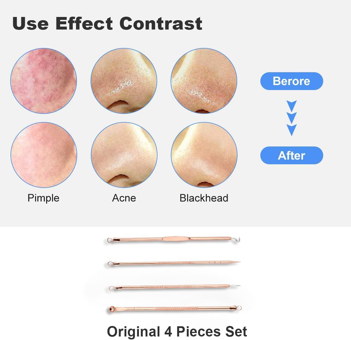 HaimiLiya Pimple Popper Tool Kit-4 Pcs Acne Needle Tools Set- Blackhead Comedone Whitehead Popping Remover Tool for Nose Face Skin Blemish Extractor Tool - Rose Gold