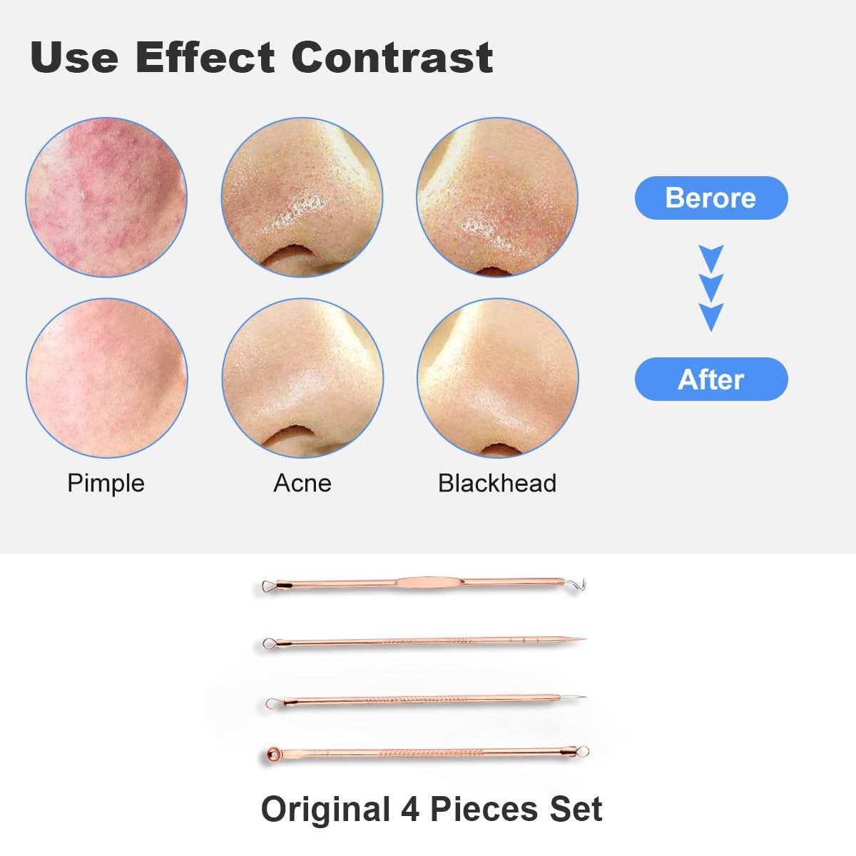 HaimiLiya Pimple Popper Tool Kit-4 Pcs Acne Needle Tools Set- Blackhead Comedone Whitehead Popping Remover Tool for Nose Face Skin Blemish Extractor Tool - Rose Gold