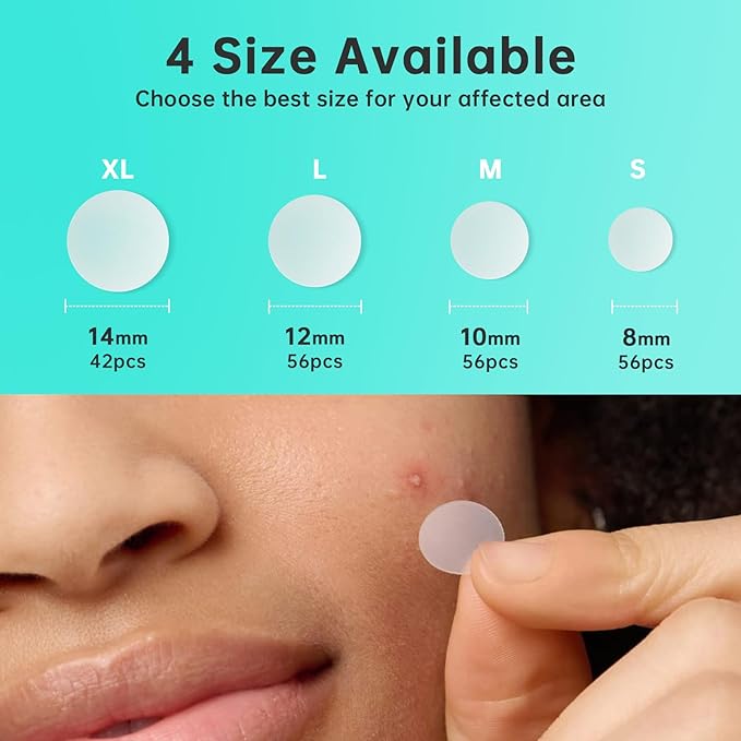 Pimple Patches for Face， Acne Patches/Hydrocolloid Patches for Covering Zits and Blemishes/Spot Care for Face，Absorb Fluid,4 size (210 Count)