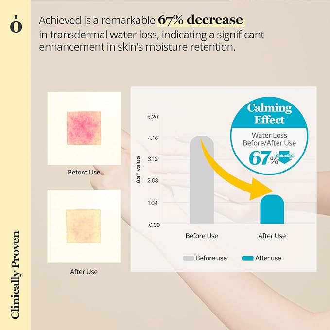ONGREDIENTS Skin Barrier Calming Lotion | Lightweight Moisturizer for Dry, Sensitive Skin | Centella, 9-Peptide Complex, Glucose, Soothing, Calming, Hydrating | Vegan, Korean Skin Care (2.70 fl Oz)