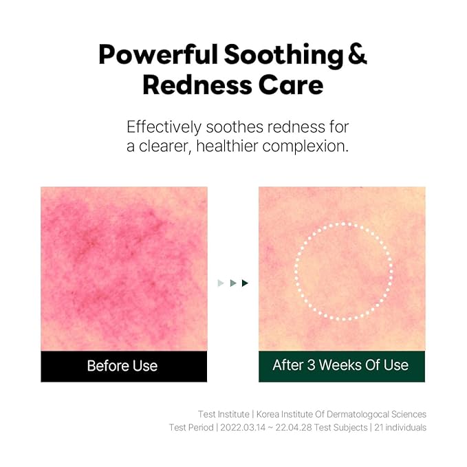 ROUND LAB Pine Calming Cica Ampoule 1.01 Fl Oz, Hydrating and Soothing Serum with Pine Cica and Hyaluronic Acid for Skin Barrier Strengthening, Gentle Exfoliation, and Deep Moisture, Korean Skincare