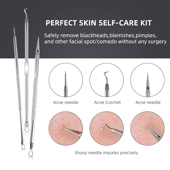 DUcare Blackhead Extractor Tool for Face,Blackhead Remover Tool, Pimple Popper Tool Kit, Extractor Tool for Comedone Zit Acne Whitehead Blemish, Stainless Steel Extraction Tools