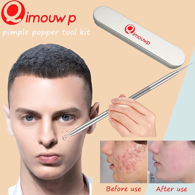 Pimple Popper Tool Kit, Blackhead Remover Tools, 16 PCS Professional Stainless Tweezers Acne Comedone Extractor Pimple Needle Tool for Blemish Whitehead Ingrown Hair Cyst Removal Beauty Tools for Face