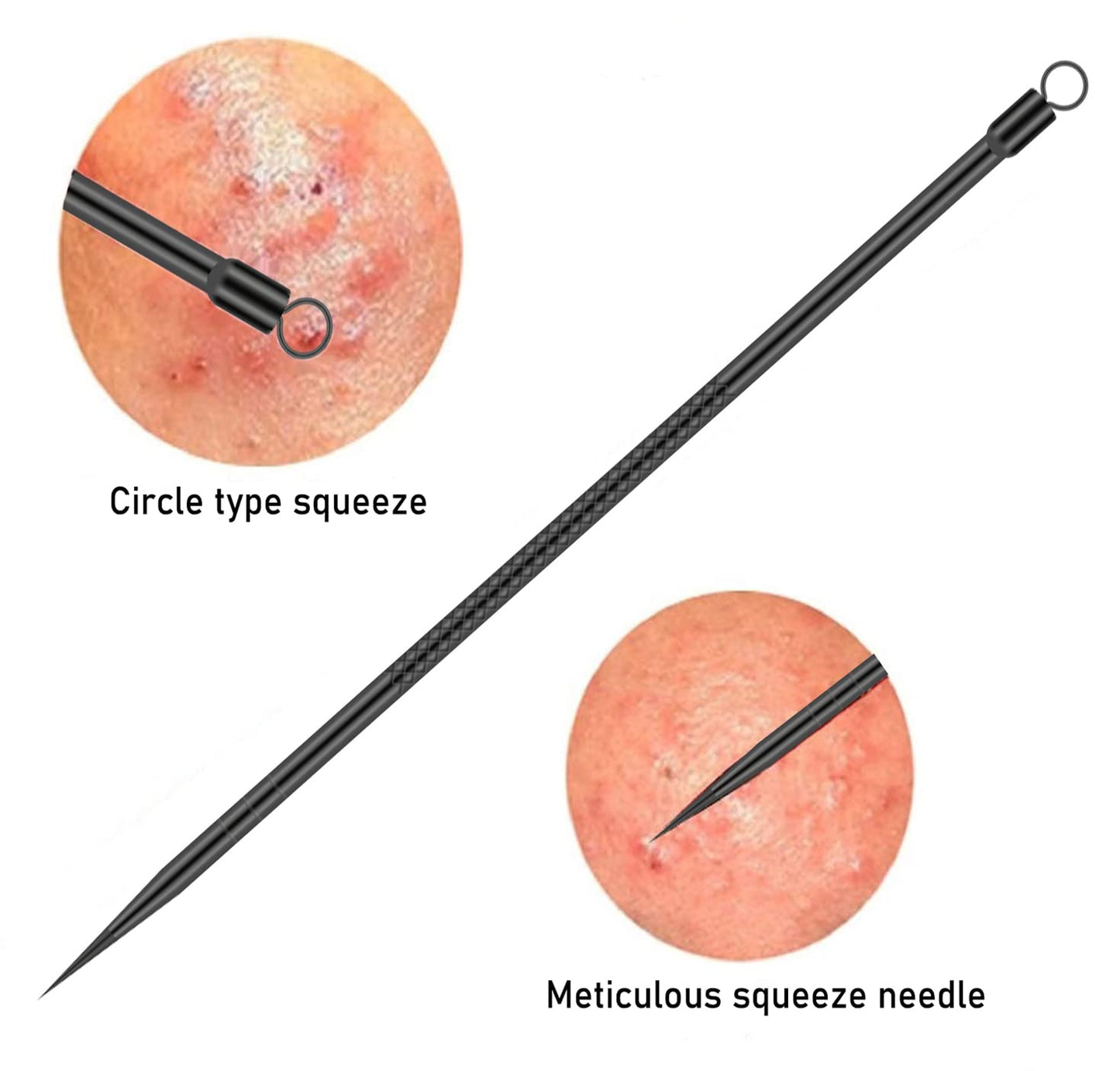 Blackhead Remover Pimple Popper Tool Kit 4 Pcs Acne Comedone Zit Blackhead Extractor Tool for Nose Face,Stainless Steel Whitehead Popping Removal Tool Set